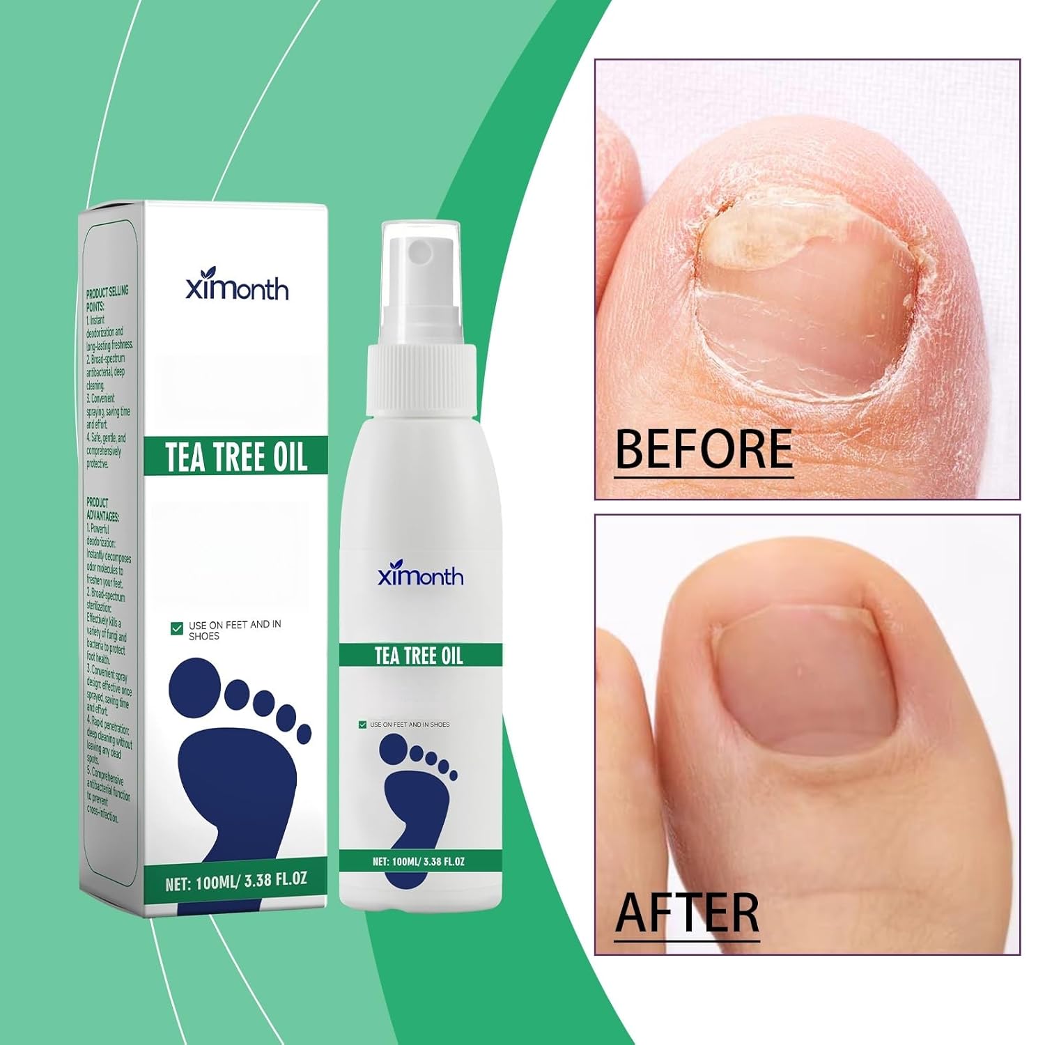 معقم للقدمين بزيت شجرة الشاي - 4